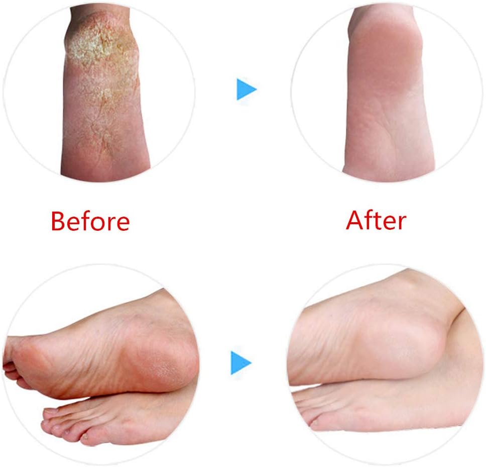 Moisturizing Socks ( 2 pairs total 4 pieces)
